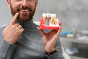 Can you get dental implants after having dentures