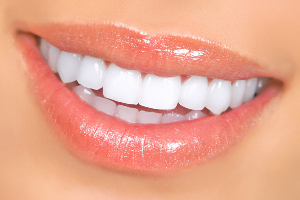 How to treat burned gums from teeth whitening