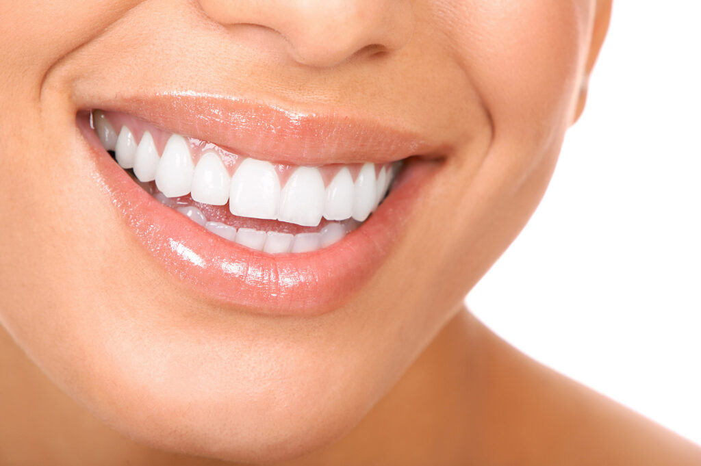 Does dental cleaning whiten teeth